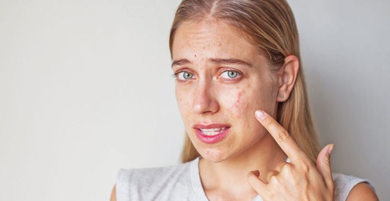 Skin problems when quitting smoking