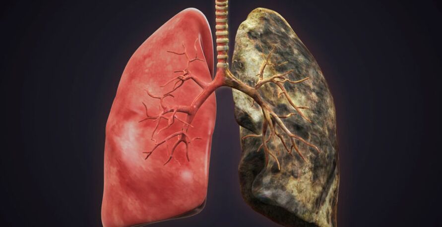Smoker's lungs and quitting lungs